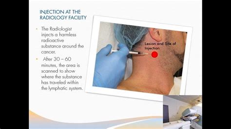 Lymph Node Biopsy .